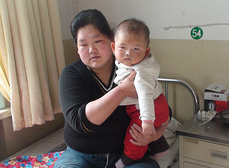 石家庄眼科医院免费为7个月先天性白内障患儿