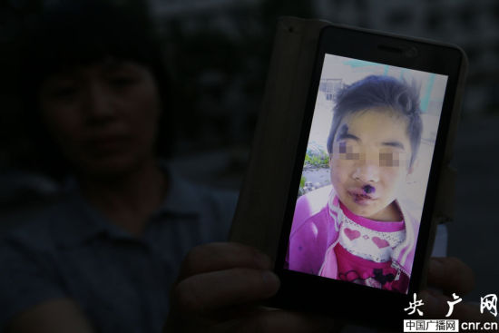保定女童北京国学班遭虐待:锤砸手脚针刺指尖